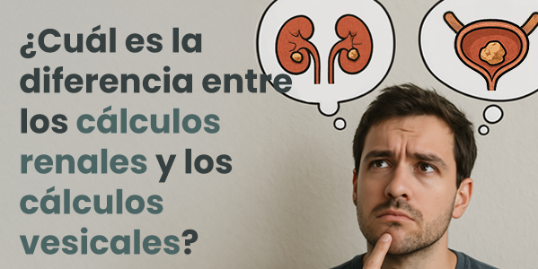 ¿Cuál es la diferencia entre los cálculos renales y los cálculos vesicales?