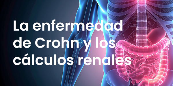 LA ENFERMEDAD DE CHRON Y LOS CÁLCULOS RENALES