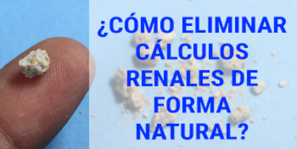 ¿Cómo eliminar cálculos renales de forma natural?