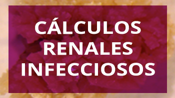 Cálculos renales infecciosos