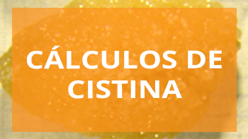 Cálculos cistina