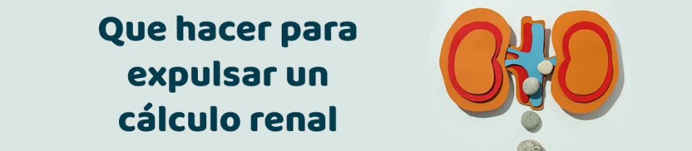 Que hacer para expulsar un cálculo renal