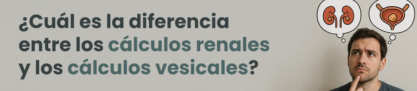 ¿Cuál es la diferencia entre los cálculos renales y los cálculos vesicales?