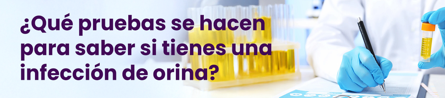 ¿Qué pruebas se hacen para saber si tienes una infección de orina?